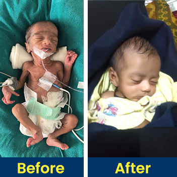 Success Story, Emergency Medical Support, Child Help Foundation